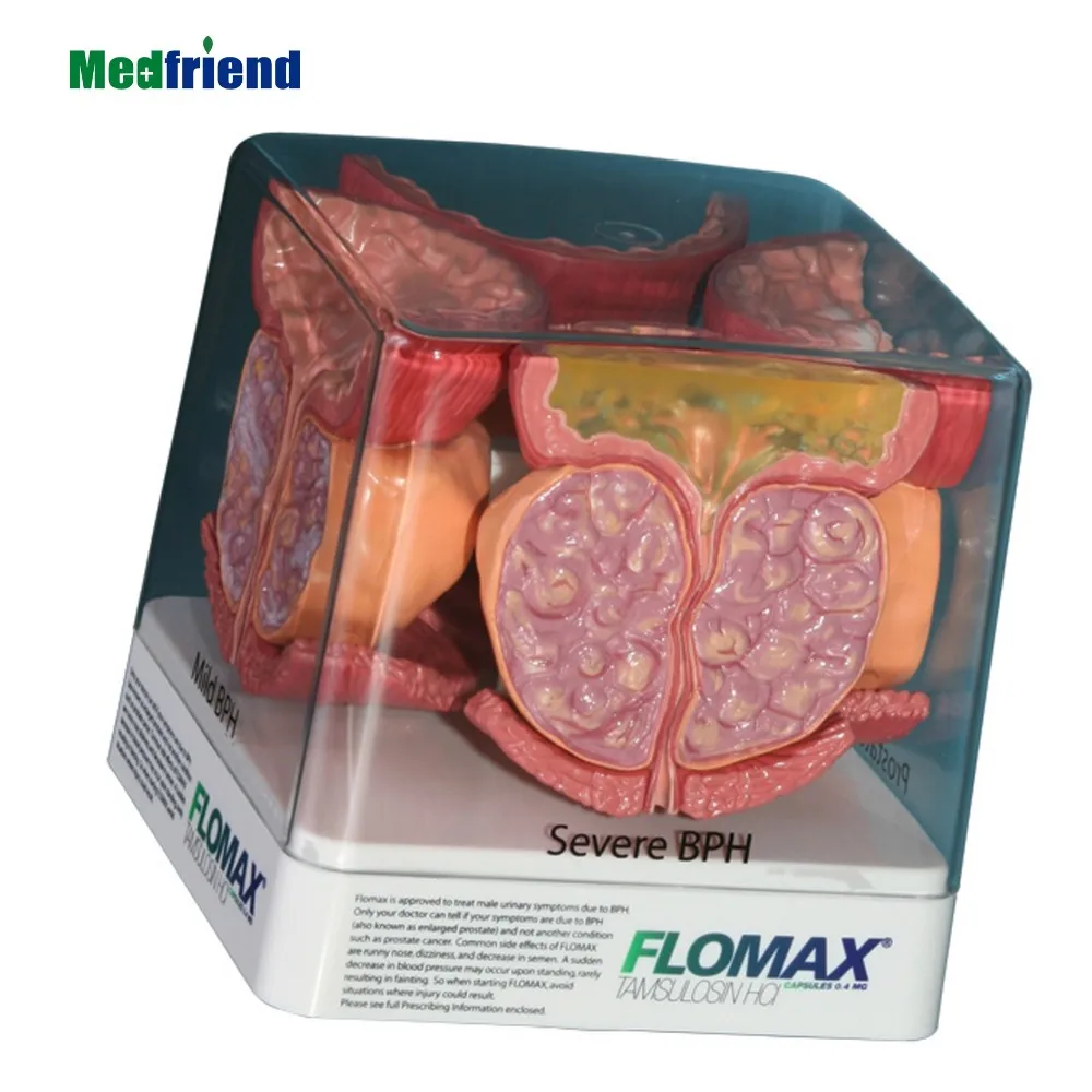 工厂价格先进解剖四面前列腺模型