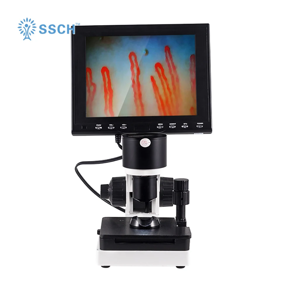 

color video capillaroscope microcirculation microscope for sub-health diagnosis with CE