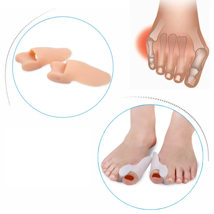 

factory wholesale sebs foot hallux valgus relief silicone gel bunion corrector big toe protector straightener separator, White, nude