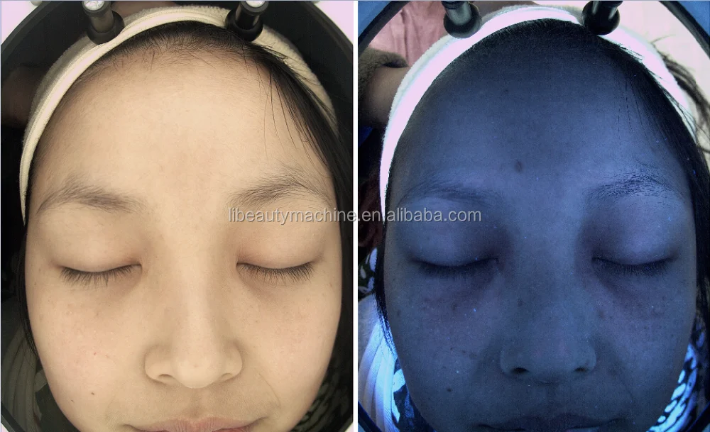 Magic Mirror Facial Skin Analyser Analyzer 3.png