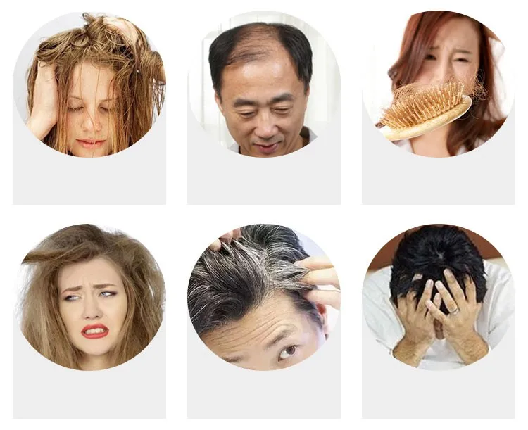laser hair growth comb.jpg_.webp