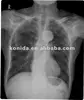 dry image films,medical x-ray film,medical dry film, agfa 5302,5000,5500,5530,3000 camera