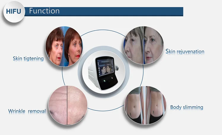 3d hifu focused ultrasound for skin care