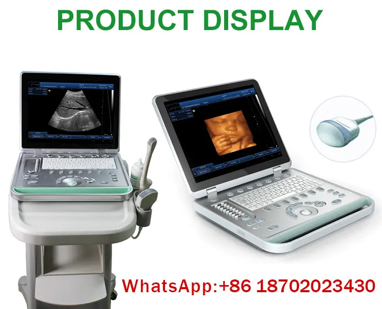 In A039 Medical Portable Black And White 4d Ultrasound Machine Price