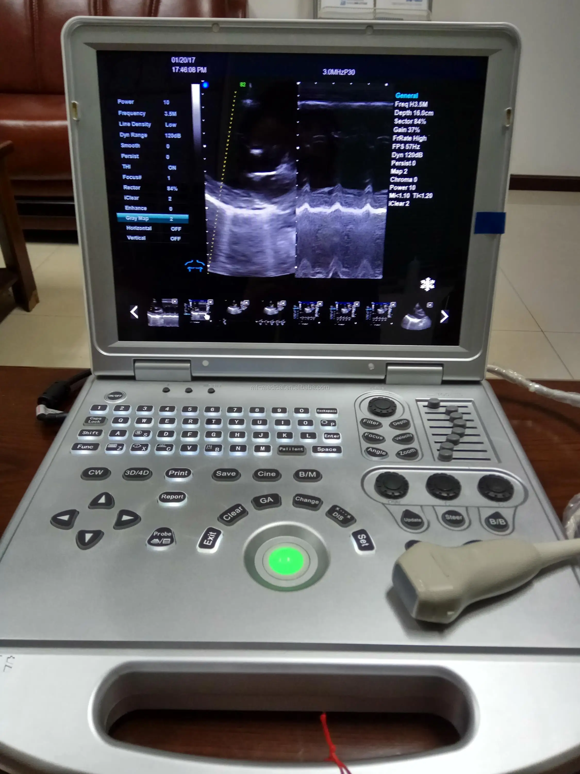 Public Use for Hospital and Surgical Medical Equipment Ultrasound Machine