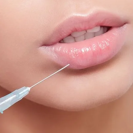 

1ml 2ml hyaluronic acid buy dermal filler online for tear trough lip plumping hollow filling