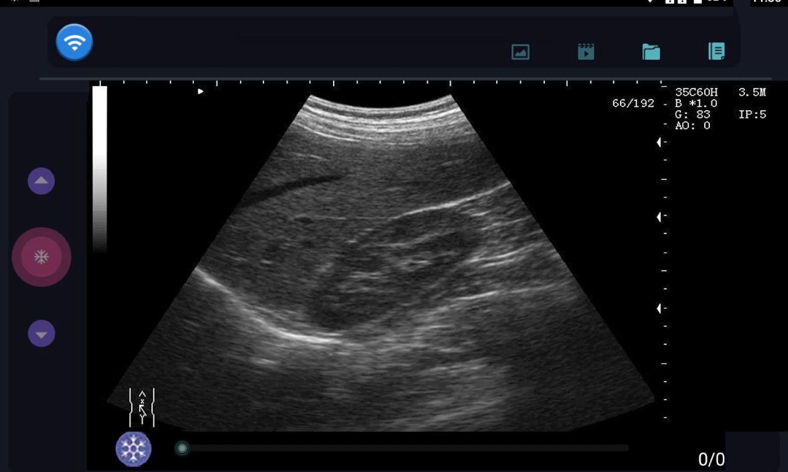 Wireless Ultrasound Probe