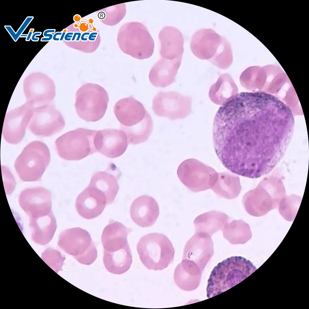 
Hematology Prepared Slides Blood Smear Prepared Slides 