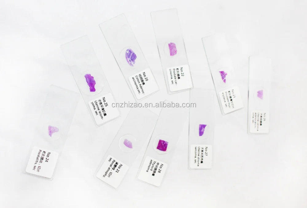 Инструменты для патологоанатомического вскрытия названия. Сбор материала для микробиологических исследований. Макет легкого человека. Патологический набор. Инструменты для патологоанатомического вскрытия ветеринария.