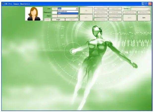Iris analyzer-1.jpg