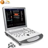 Floor price best seller in china 2D 3D software color doppler ultrasound for home