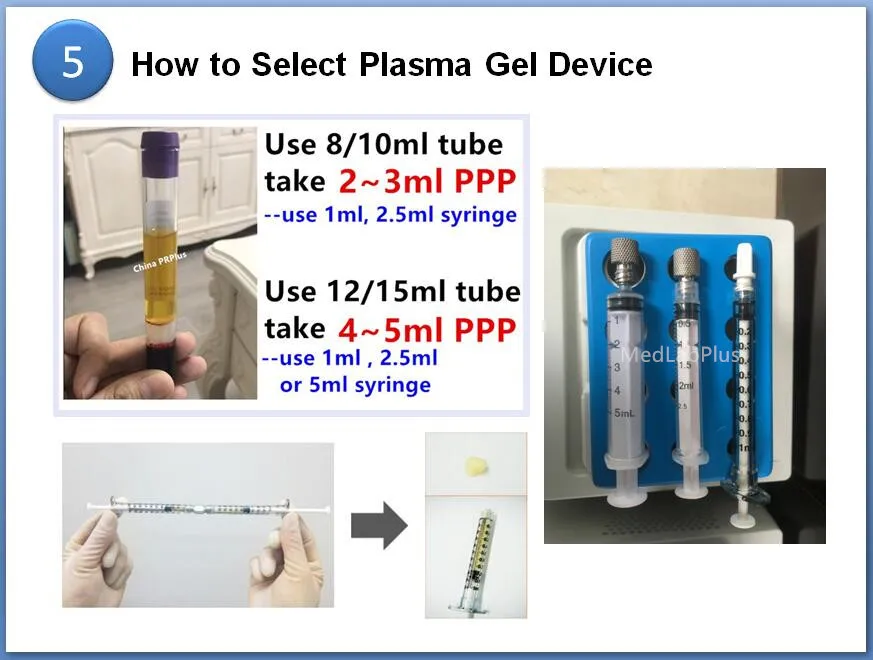 plasma gel maker 06.jpg