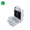 Portable notebook laptop ultrasound machine scanner system digital