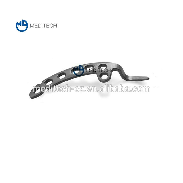 ホット販売医療チタン合金鎖骨クリュートラウマプレート Buy トラウマプレート 鎖骨クリュープレート 医療チタントラウマプレート Product On Alibaba Com