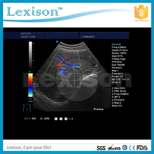 Convex Probe-Liver with logo 1.jpg