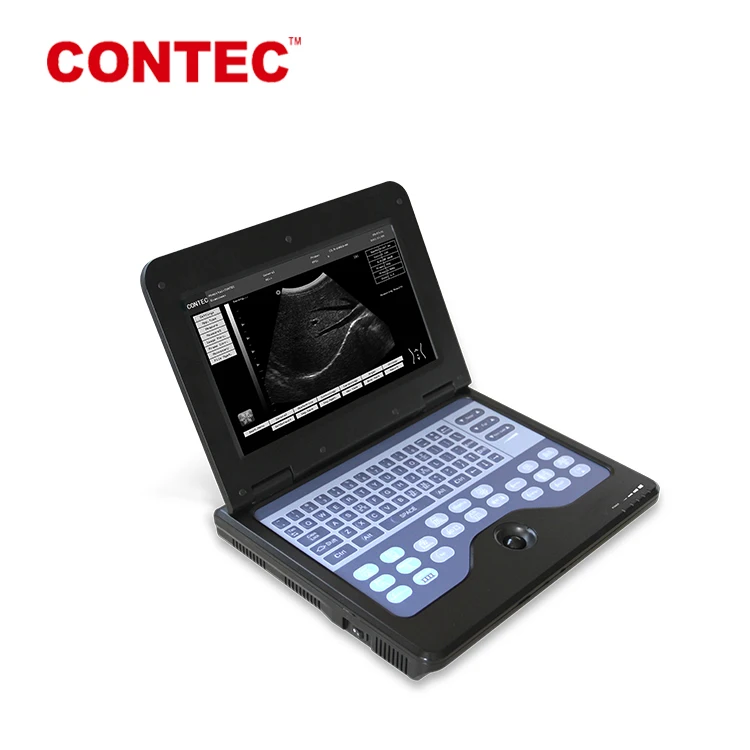 contecmed portable ultrasound china portable ultrasonic diagnostic doppler ultrasound equipment