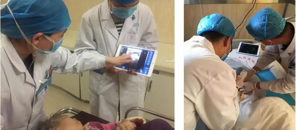 Doppler ultrasound Transducer USG small ultrasonic transducer wireless ultrasound Probe Machine