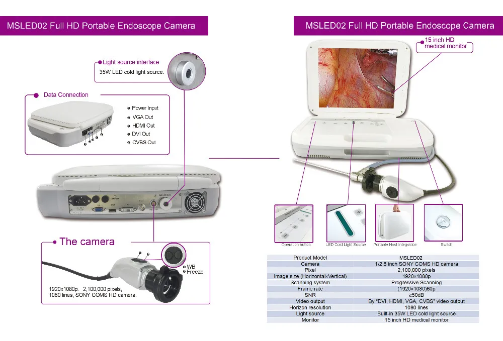 Full Integrated Endoscopic Camera With Dvi,Hdmi,Vga,Cvbs Video Output