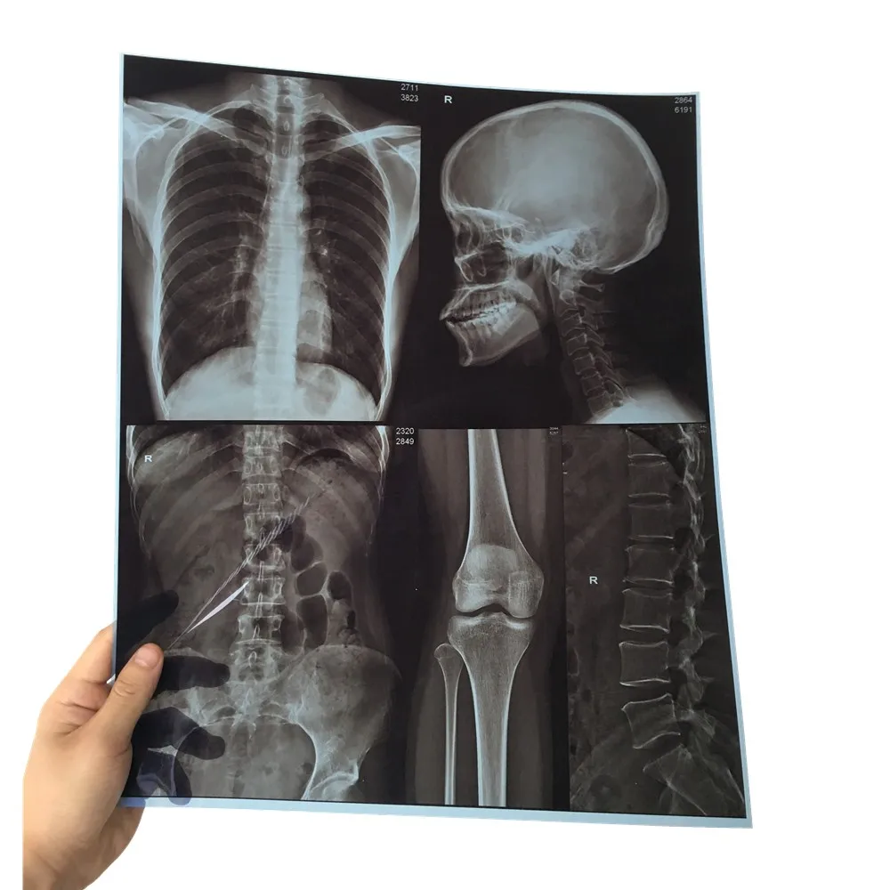 X ray Medical Dry Laser X-ray Imaging Film for medial devices