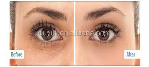 best cream for crow's feet eyes