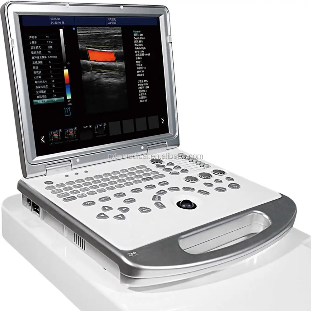 Special stylish medical ultrasound color doppler laptop