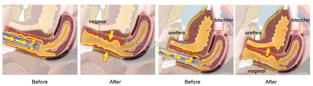 0WXRKTB0Q69AJ4Y%_W8IA`Y