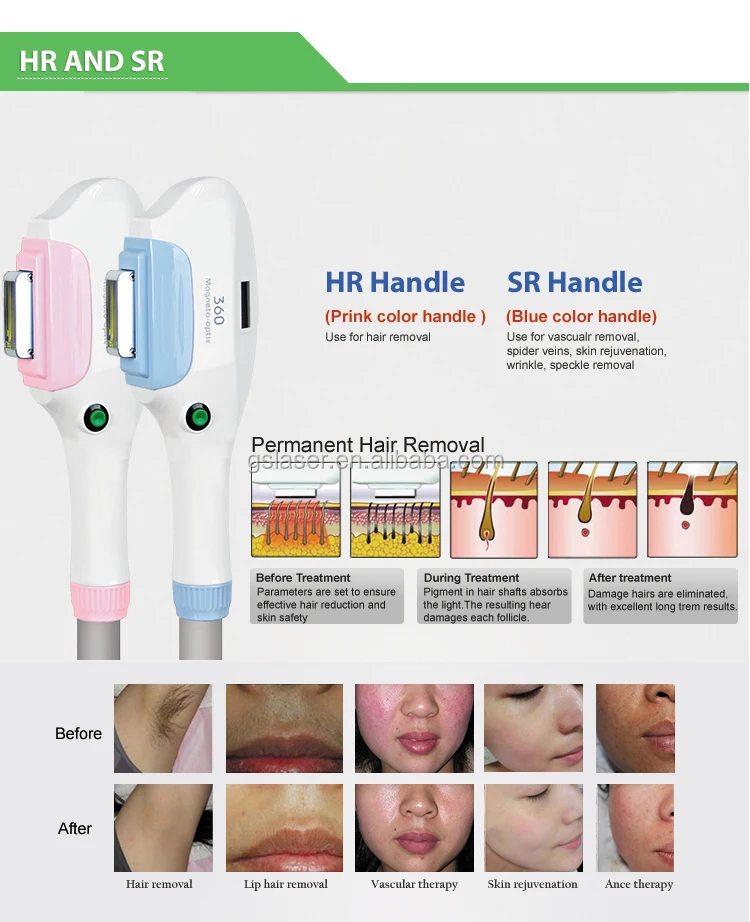 Epilight Hair Removal Machine Braun Hair Removal Machine Buy Epilight