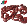 black purple speckled kidney beans, price of white kidney beans, large black speckled kidney beans