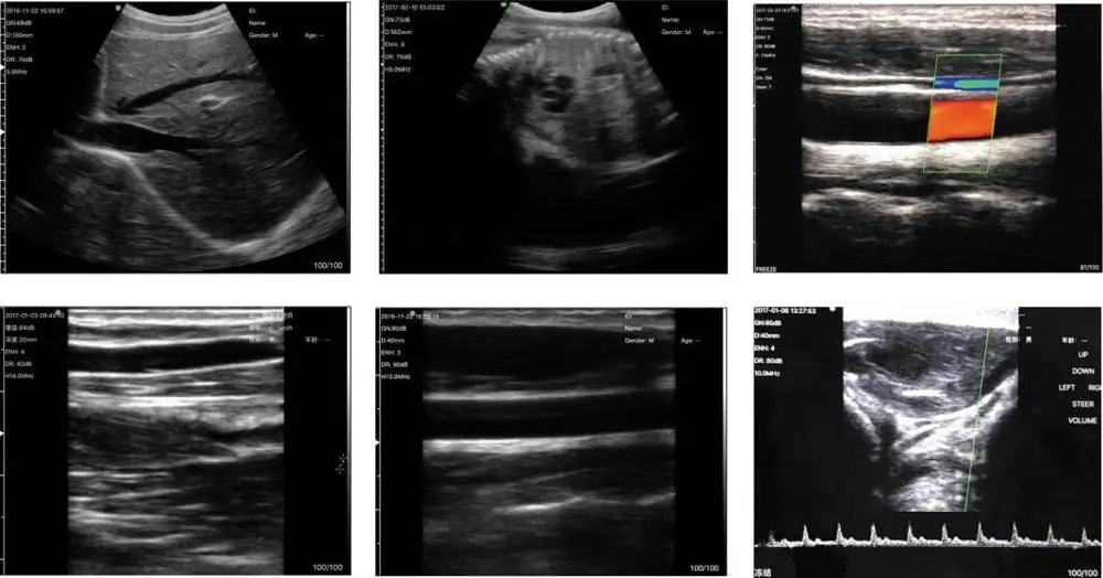 Doppler ultrasound Transducer USG small ultrasonic transducer wireless ultrasound Probe Machine