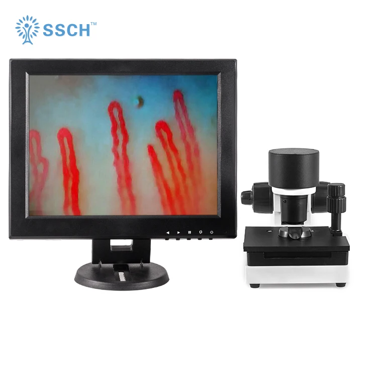 

blood microcirculation microscope/nail-fold capillary microscope