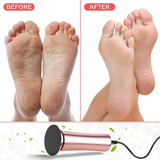 
Electric Callus Remover Professional Pedicure Tools Foot File 