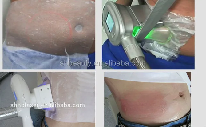 Big size 34X42 110g antifreeze membrane cryo anti freeze membrane