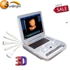 laptop computer platform medical ultrasound scanner