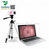 YSSW3301 accurate evaluation portable digital gynecology colposcope