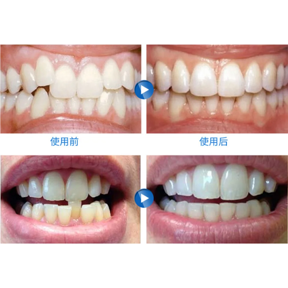 Dental Oral Orthodontic Appliance Trainer Tooth Correction Teeth Retainer Corrector Buy Bulk Dental Floss Dental Floss Products Dental Floss Pick Product On Alibaba Com