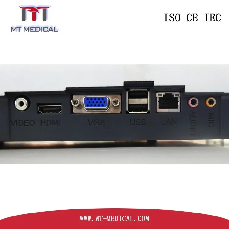 Full digital 4D portable Color Doppler ultrasound machine on sale with factory price