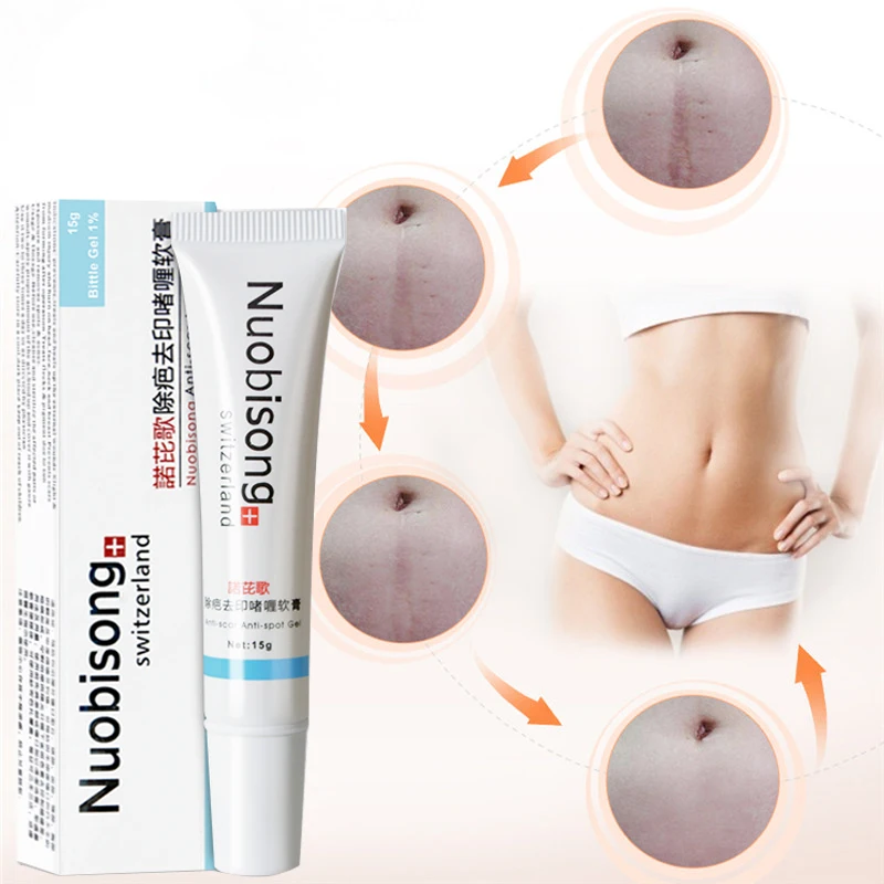 

15g High Quality Acne Treatment Product Nuobisong Scar Remover Specific Scar Removal Cream