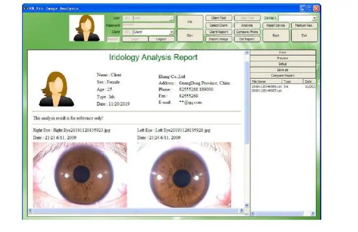 iris analyzer-5.jpg
