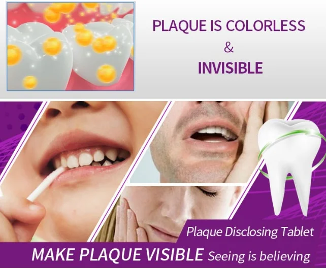 Disclosing plaque teeth tablet for detecting plaque, View Disclosing