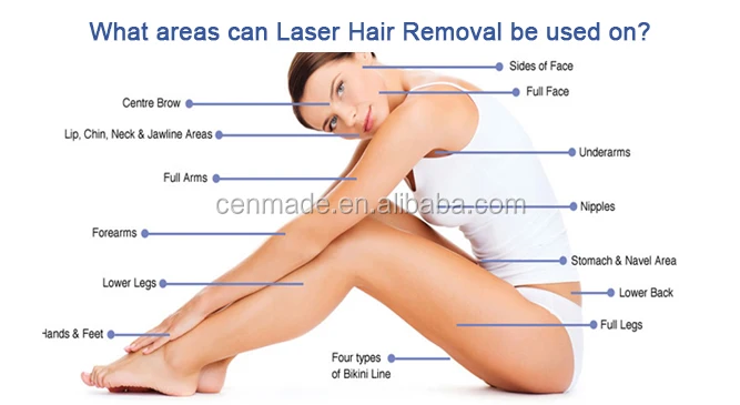 IPL hair removal.jpg