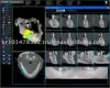 Implant Software - CT