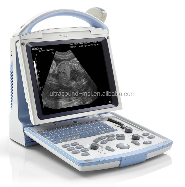 Mindray Ultrasound Scan in