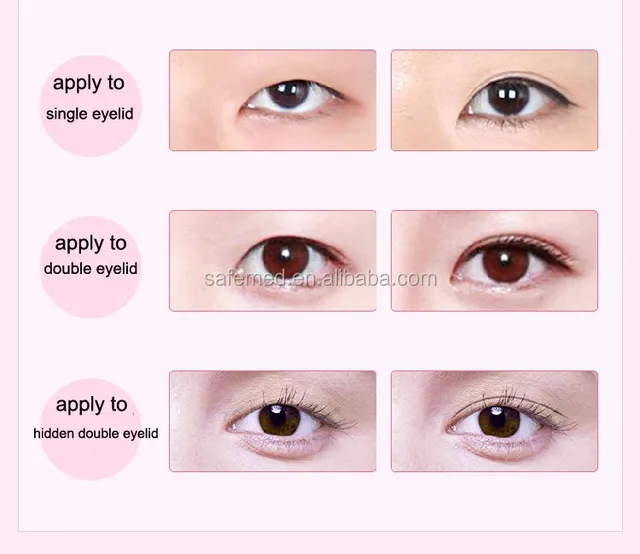 single eyelid double eyelid