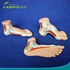 19 Positions Marked Foot Models, Normal Foot, Flat Foot and Club Foot