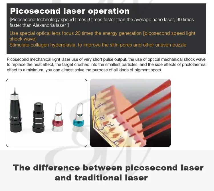 Sanwei SW-C03 pico laser tattoo removal freckle removal beauty equipment picosecond system