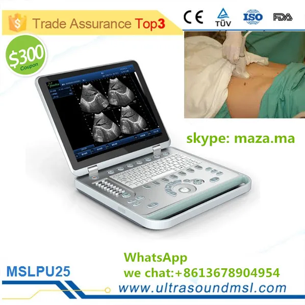 Mslpu34 Brand New Ultrasound Portable Medical Ultrasound Machine For