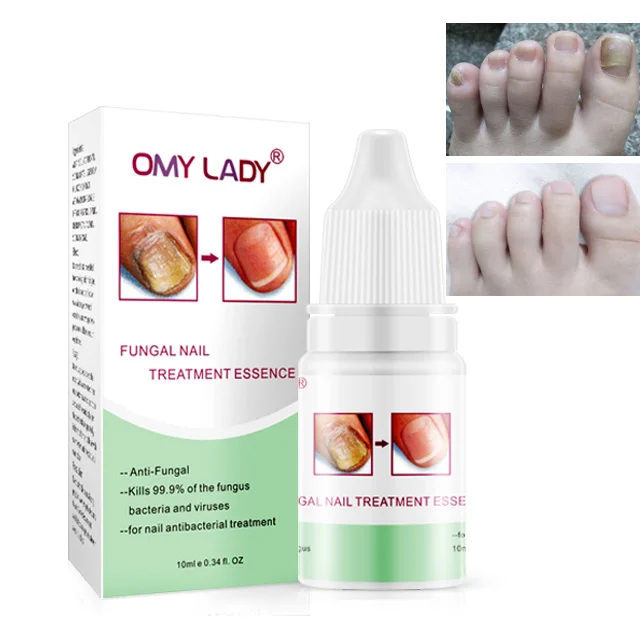 

OMY LADY 10ml Fungus Stop Nail Fungal Nail Repair Serum for Nail Salon