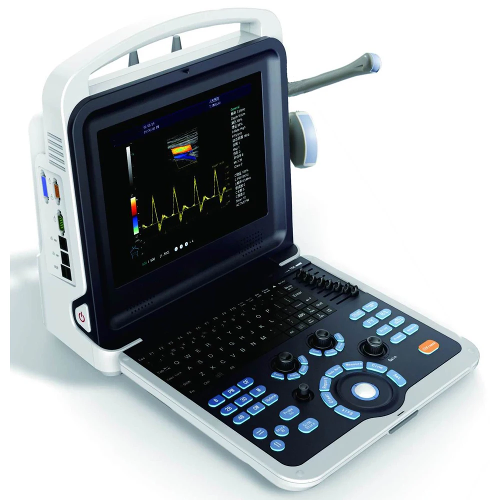 China Portable 4D Ultrasound Machine For Pregnancy, View ultrasound