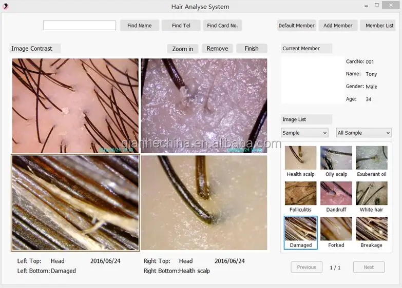 2019 Hair And Scalp Analysis System 8.0mp Hair Analysis Machine Buy