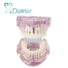 best quality of orthodontic model with lingual bracket for demonstrating the exact position of bracket and practice wires
